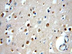 GBA Rabbit anti-Human, Polyclonal, Proteintech 150 &mu;L; Unconjugated:Antibodies,