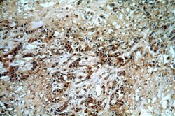 GBA Rabbit anti-Human, Polyclonal, Proteintech 150 &mu;L; Unconjugated:Antibodies,