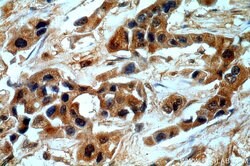 GBA Rabbit anti-Human, Polyclonal, Proteintech 150 &mu;L; Unconjugated:Antibodies,