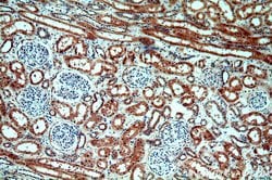 ABHD12B Rabbit anti-Human, Mouse, Polyclonal, Proteintech:Antibodies:Primary