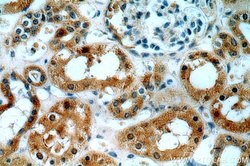 ABHD12B Rabbit anti-Human, Mouse, Polyclonal, Proteintech:Antibodies:Primary