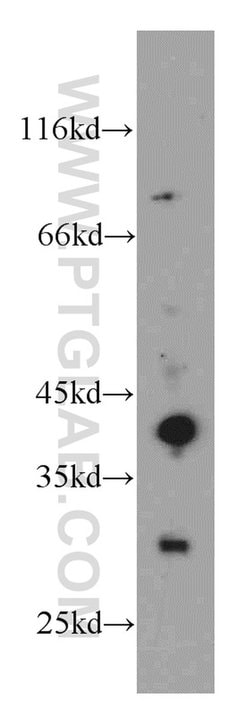 ABHD12B Rabbit anti-Human, Mouse, Polyclonal, Proteintech:Antibodies:Primary