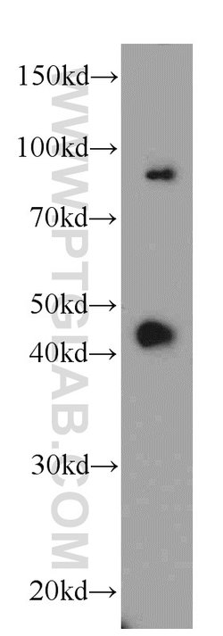 ABHD12B Rabbit anti-Human, Mouse, Polyclonal, Proteintech:Antibodies:Primary