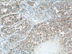 ZIP4 Rabbit anti-Human, Mouse, Polyclonal, Proteintech:Antibodies:Primary