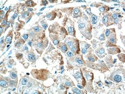 ZIP4 Rabbit anti-Human, Mouse, Polyclonal, Proteintech:Antibodies:Primary