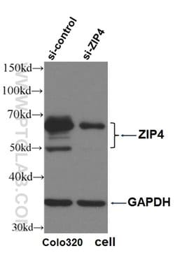 ZIP4 Rabbit anti-Human, Mouse, Polyclonal, Proteintech:Antibodies:Primary