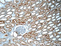 ZIP4 Rabbit anti-Human, Mouse, Polyclonal, Proteintech:Antibodies:Primary