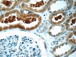 ZIP4 Rabbit anti-Human, Mouse, Polyclonal, Proteintech:Antibodies:Primary