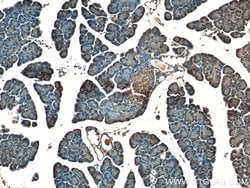 ZIP4 Rabbit anti-Human, Mouse, Polyclonal, Proteintech:Antibodies:Primary