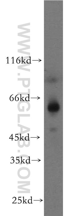ZIP4 Rabbit anti-Human, Mouse, Polyclonal, Proteintech:Antibodies:Primary