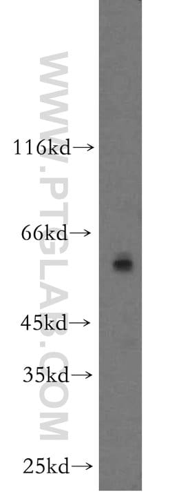 ZIP4 Rabbit anti-Human, Mouse, Polyclonal, Proteintech:Antibodies:Primary