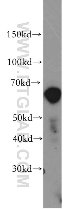ZIP4 Rabbit anti-Human, Mouse, Polyclonal, Proteintech:Antibodies:Primary