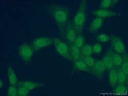 SOX8 Rabbit anti-Human, Polyclonal, Proteintech:Antibodies:Primary Antibodies