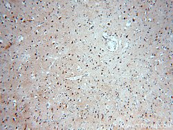 SOX8 Rabbit anti-Human, Polyclonal, Proteintech:Antibodies:Primary Antibodies