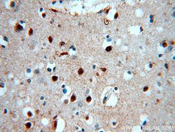 SOX8 Rabbit anti-Human, Polyclonal, Proteintech:Antibodies:Primary Antibodies