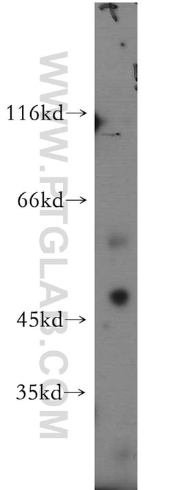 SOX8 Rabbit anti-Human, Polyclonal, Proteintech:Antibodies:Primary Antibodies
