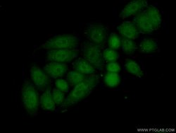 HOXC10 Rabbit anti-Human, Mouse, Polyclonal, Proteintech 150 &mu;L; Unconjugated:Antibodies,