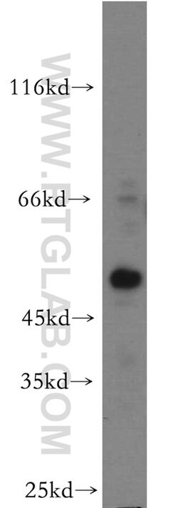 HOXC10 Rabbit anti-Human, Mouse, Polyclonal, Proteintech 150 &mu;L; Unconjugated:Antibodies,