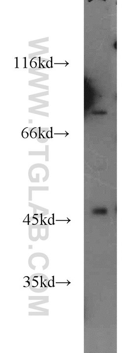 HOXC10 Rabbit anti-Human, Mouse, Polyclonal, Proteintech 150 &mu;L; Unconjugated:Antibodies,