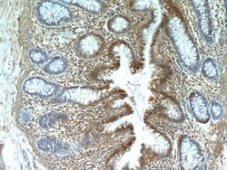 CXCR2 Rabbit anti-Human, Polyclonal, Proteintech:Antibodies:Primary Antibodies