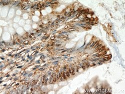 CXCR2 Rabbit anti-Human, Polyclonal, Proteintech:Antibodies:Primary Antibodies
