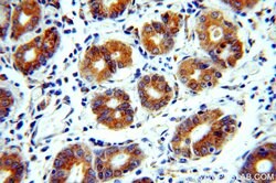 CHCHD6 Rabbit anti-Human, Polyclonal, Proteintech:Antibodies:Primary Antibodies