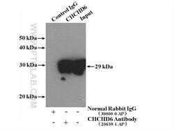 CHCHD6 Rabbit anti-Human, Polyclonal, Proteintech:Antibodies:Primary Antibodies
