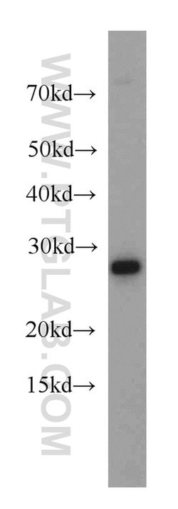 CHCHD6 Rabbit anti-Human, Polyclonal, Proteintech:Antibodies:Primary Antibodies