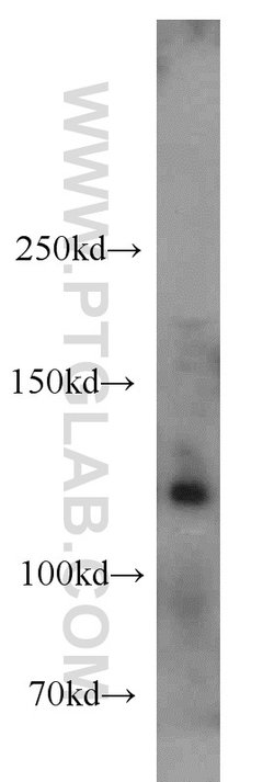 ANO2 Rabbit anti-Human, Mouse, Rat, Polyclonal, Proteintech 150 &mu;L;