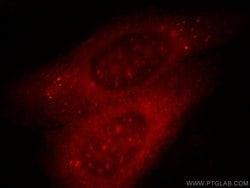 ANO2 Rabbit anti-Human, Mouse, Rat, Polyclonal, Proteintech 150 &mu;L;