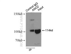 ANO2 Rabbit anti-Human, Mouse, Rat, Polyclonal, Proteintech 150 &mu;L;
