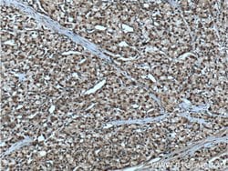 SMARCB1 Rabbit anti-Human, Mouse, Rat, Polyclonal, Proteintech:Antibodies:Primary