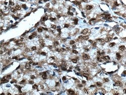 SMARCB1 Rabbit anti-Human, Mouse, Rat, Polyclonal, Proteintech:Antibodies:Primary