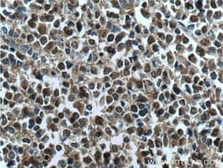 SMARCB1 Rabbit anti-Human, Mouse, Rat, Polyclonal, Proteintech:Antibodies:Primary