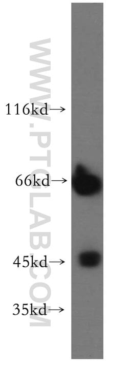SMARCB1 Rabbit anti-Human, Mouse, Rat, Polyclonal, Proteintech:Antibodies:Primary