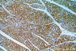 CaMKII delta Rabbit anti-Human, Mouse, Rat, Polyclonal, Proteintech 150