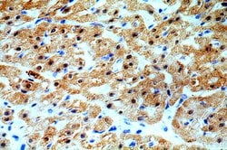 CaMKII delta Rabbit anti-Human, Mouse, Rat, Polyclonal, Proteintech 150