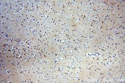 CaMKII delta Rabbit anti-Human, Mouse, Rat, Polyclonal, Proteintech 150