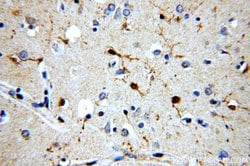 CaMKII delta Rabbit anti-Human, Mouse, Rat, Polyclonal, Proteintech 150