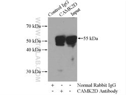 CaMKII delta Rabbit anti-Human, Mouse, Rat, Polyclonal, Proteintech 150