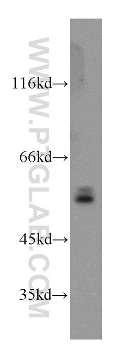 CaMKII delta Rabbit anti-Human, Mouse, Rat, Polyclonal, Proteintech 150