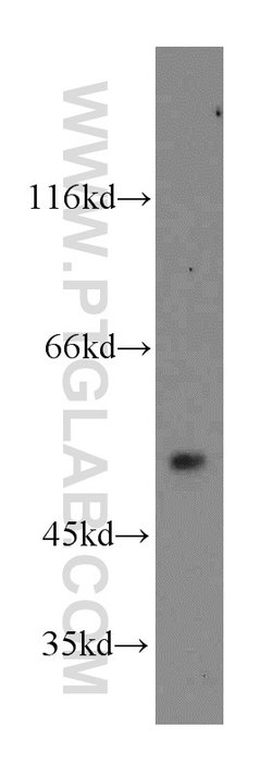 CaMKII delta Rabbit anti-Human, Mouse, Rat, Polyclonal, Proteintech 150