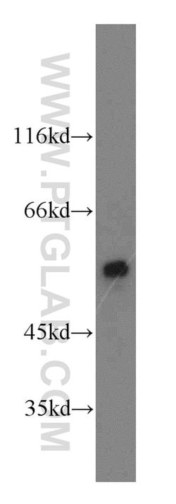 CaMKII delta Rabbit anti-Human, Mouse, Rat, Polyclonal, Proteintech 150