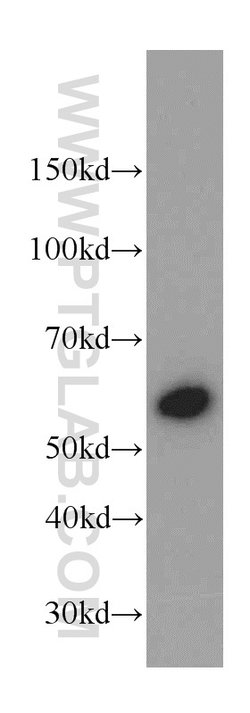 CaMKII delta Rabbit anti-Human, Mouse, Rat, Polyclonal, Proteintech 150