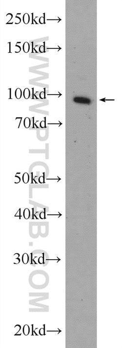 Transportin-1 Rabbit anti-Human, Mouse, Polyclonal, Proteintech 150 &mu;L;