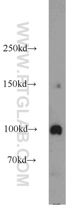 Transportin-1 Rabbit anti-Human, Mouse, Polyclonal, Proteintech 150 &mu;L;