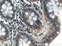 FLNB Rabbit anti-Human, Mouse, Rat, Polyclonal, Proteintech 150 &mu;L;