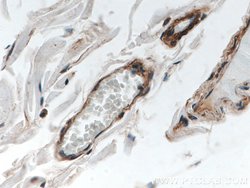 FLNB Rabbit anti-Human, Mouse, Rat, Polyclonal, Proteintech 150 &mu;L;