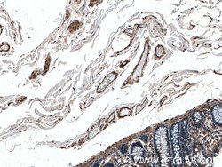 FLNB Rabbit anti-Human, Mouse, Rat, Polyclonal, Proteintech 150 &mu;L;
