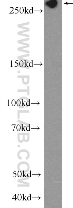 FLNB Rabbit anti-Human, Mouse, Rat, Polyclonal, Proteintech 150 &mu;L;
